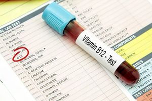 نشانه های کمبود ویتامین B۱۲ که در صورت ظاهر می‌شود