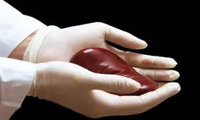 فروش کلیه از ۱۲۰ تا ۲۵۰ میلیون در شهرستان ها