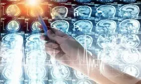 وجود تومور خوش‌خیم مرتبط با دیابت و فشارخون در ۱۰ درصد بزرگسالان