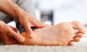 کمبود این ویتامین سبب ترک خوردن پاشنه پا می‌شود