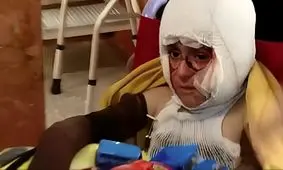 کیان برادر رایان کوچکترین شهید ایران؛ کودکی که دست‌هایش از سوختگی توان ندارند 