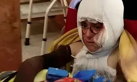 کیان برادر رایان کوچکترین شهید ایران؛ کودکی که دست‌هایش از سوختگی توان ندارند 