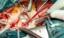 اعتراض پزشکان به حقوق کم؛ عمل جراحی قلب باز نزدیک ۲ میلیاردتومان است نه ۲۰۰میلیون!