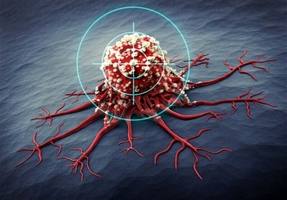 روند افزایشی سرطان ها؛ ۳ سرطان شایع در زنان و مردان