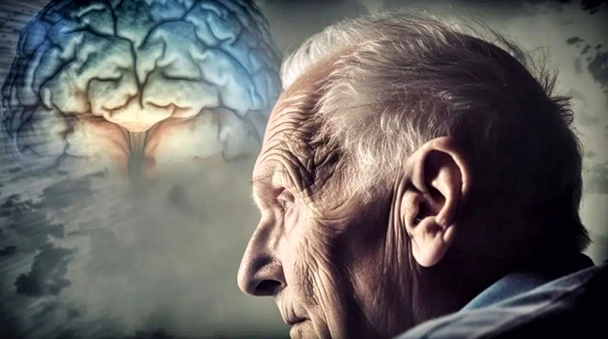 همه چیز درباره آلزایمر/ اینفوگرافیک