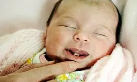 همه چیز درباره علل تولد نوزاد با دندان و مشکلات آن