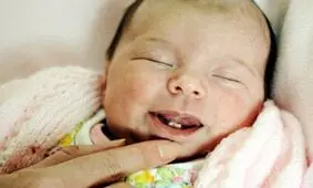 همه چیز درباره علل تولد نوزاد با دندان و مشکلات آن