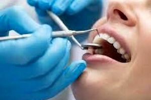 جرم گیری دندان خوب است یا بد؟