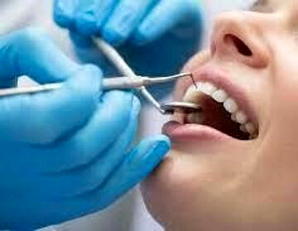 جرم گیری دندان خوب است یا بد؟