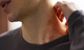 تسکین فوری عرق‌سوز با ۵ روش ساده 