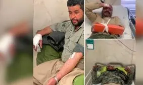 شلیک شکارچیان غیرمجاز به 3 محیط بان در پارک ملی