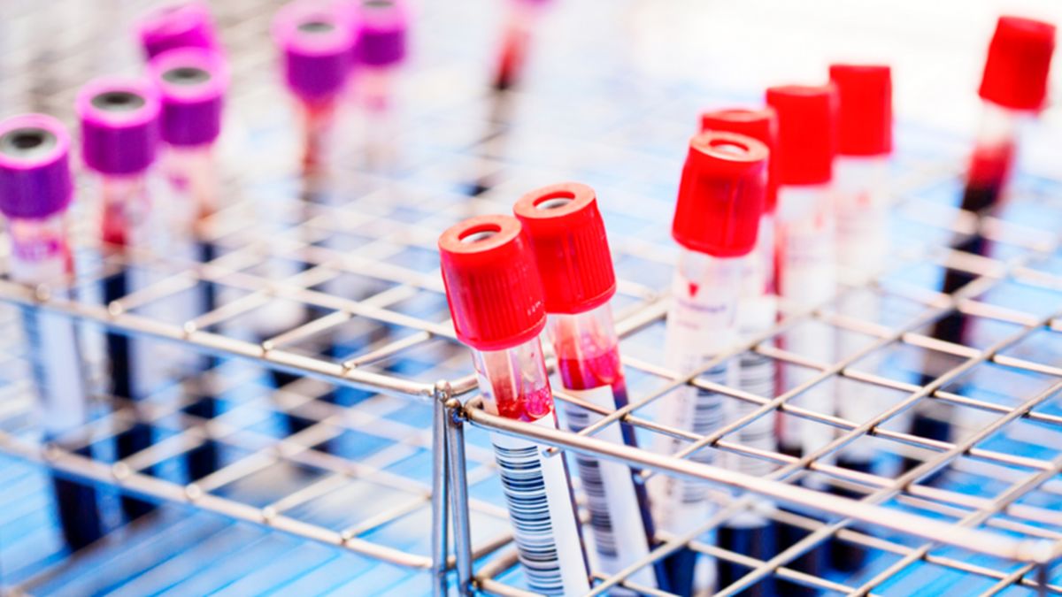 دانشمندان موفق به حذف ویروس HIV از سلول های آلوده شدهاند
