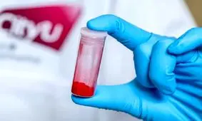 نابودی سلول های سرطانی با نور