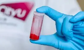 نابودی سلول های سرطانی با نور