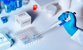 حذف برخی آزمایش ها به دلیل نبود کیت تشخیصی