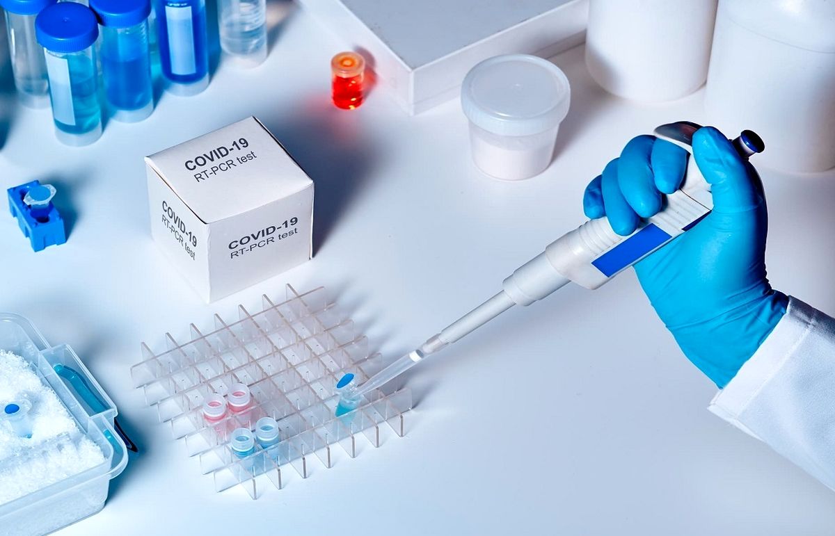 حذف برخی آزمایش ها به دلیل نبود کیت تشخیصی