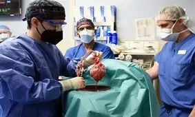 امیدی تازه در علم پزشکی؛ زنی با کلیه خوک رکورد طولانی‌ترین زندگی با عضو حیوانی را شکست