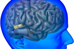 شرکت رقیب نورالینک هم «تراشه مغزی» آزمایش می‌کند

