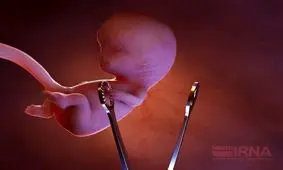 ۹۶ درصد سقط‌های جنین‌ غیرقانونی است