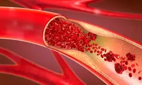 روش های اورژانسی پیشگیری از خونریزی در مجروحان