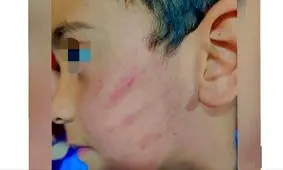 کتک زدن کودک سیستان و بلوچستانی توسط معلم 