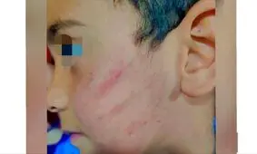 کتک زدن کودک سیستان و بلوچستانی توسط معلم 