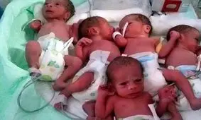 زن 33 ساله در گنبد کاووس 5 قلو به دنیا آورد