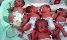 زن 33 ساله در گنبد کاووس 5 قلو به دنیا آورد