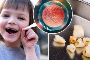 توصیه دندان پزشکان: دندان های شیری کودکان را دور نیندازید!