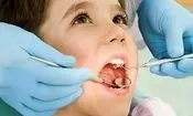 نخستین دندان دائمی؛ چرا «دندان شش» آینده لبخند کودکان را می‌سازد؟