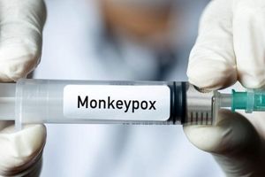 اعلام وضعیت اضطراری در آمریکا به خاطر آبله میمون