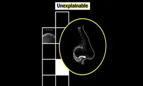 تشخیص بوی سرطان از طریق گوشی تلفن همراه