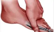 شایع‌ترین دلایل التهاب مفصلی در انگشتان پا
