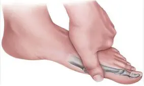 شایع‌ترین دلایل التهاب مفصلی در انگشتان پا
