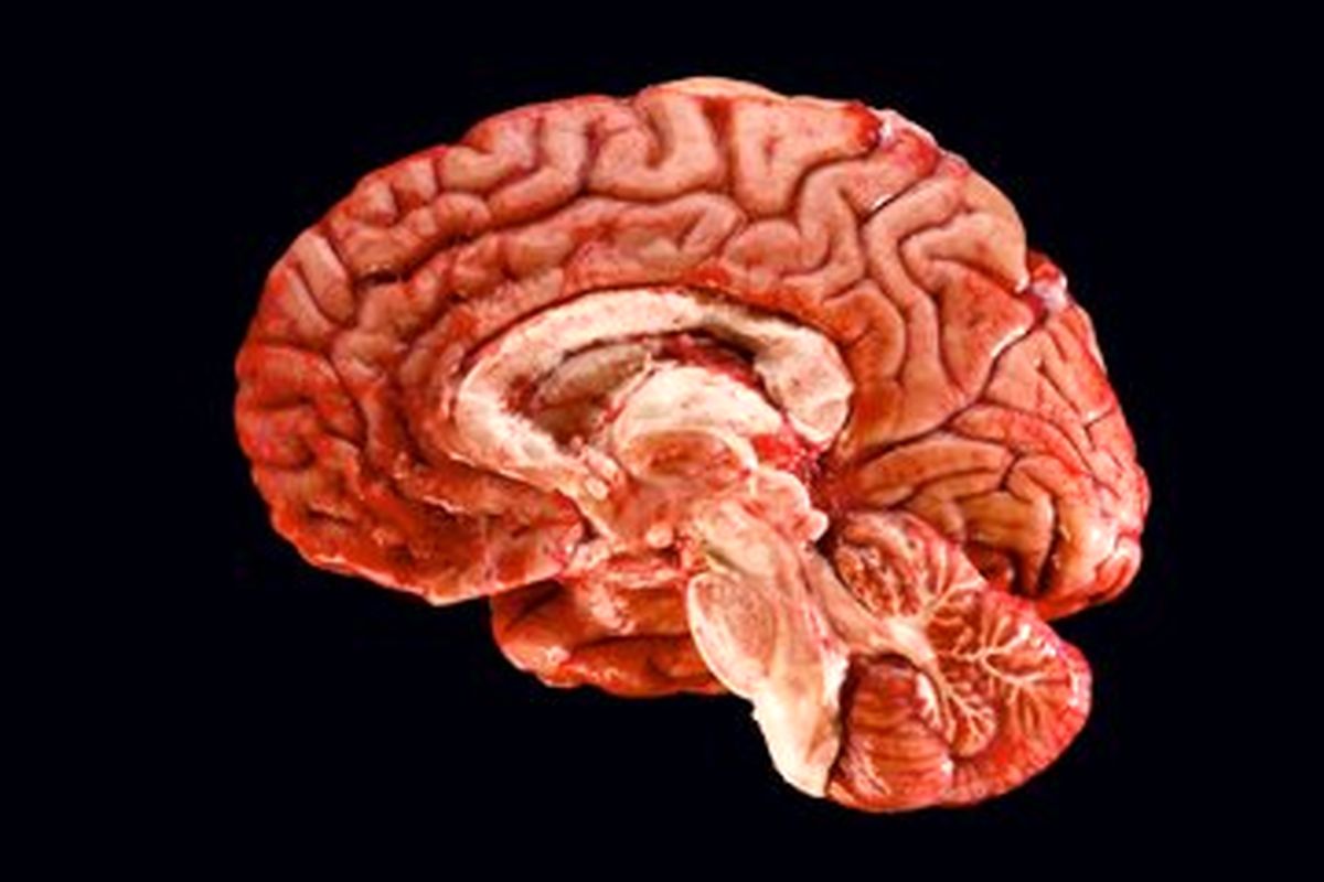 تلفن همراه سبب تومور مغزی میشود یا نه؟