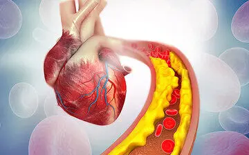 بهترین پیشنهاد برای کاهش کلسترول خون