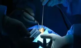 زنی در امارات به خاطر عمل بینی شوهرش را از دست داد