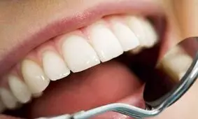 ارتباط رنگ دندان‌ با بیماری های مختلف