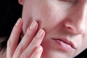 پیشگیری از باز شدن منافذ پوست