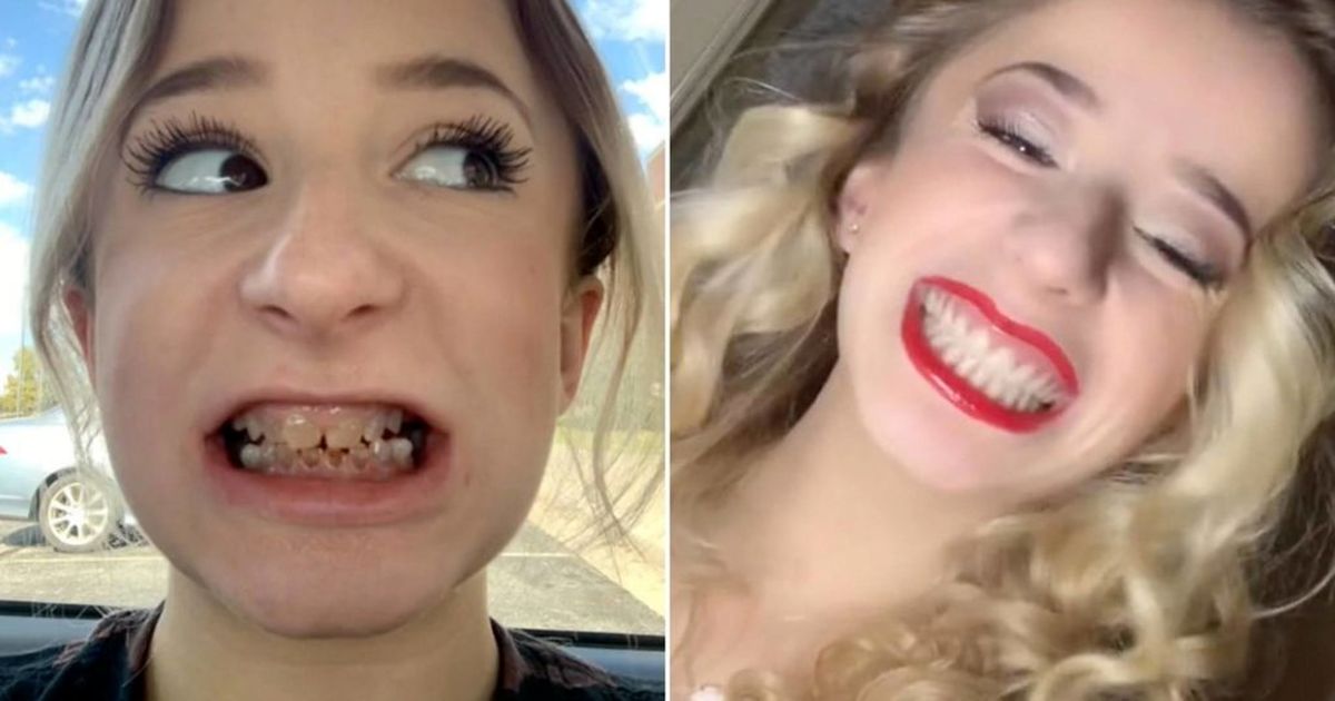 سرانجام زن جوانی که با دندان‌های شفاف به دنیا آمده بود