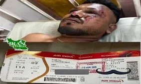 تنها بازمانده سقوط هواپیما در احمدآباد در آخرین لحظه از هواپیما بیرون پرید/ ویدئو