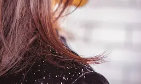 علت خارش پوست سر و روش‌های رفع آن