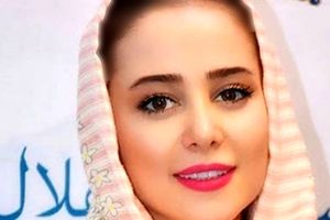 تغییر چهره فوق دردناک الناز حبیبی/ دختر کوچولوی سینما به چه روزی افتاد؟ /ویدئو