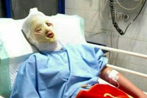 انفجار مواد محترقه باعث مصدومیت ۲ نوجوان در ورامین شد