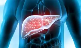 باورهای غلط برای درمان کبد چرب