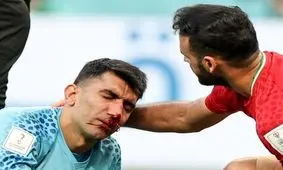 نظر علیرضا بیرانوند درباره دماغش/ ویدئو

