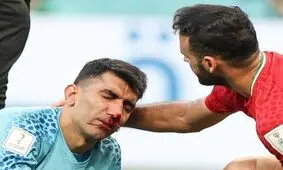 نظر علیرضا بیرانوند درباره دماغش/ ویدئو

