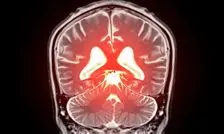 کشف امیدوارکننده برای درمان زوال عقل: کنترل یک پروتئین خاص می‌تواند فشار خون مغز را اصلاح کند