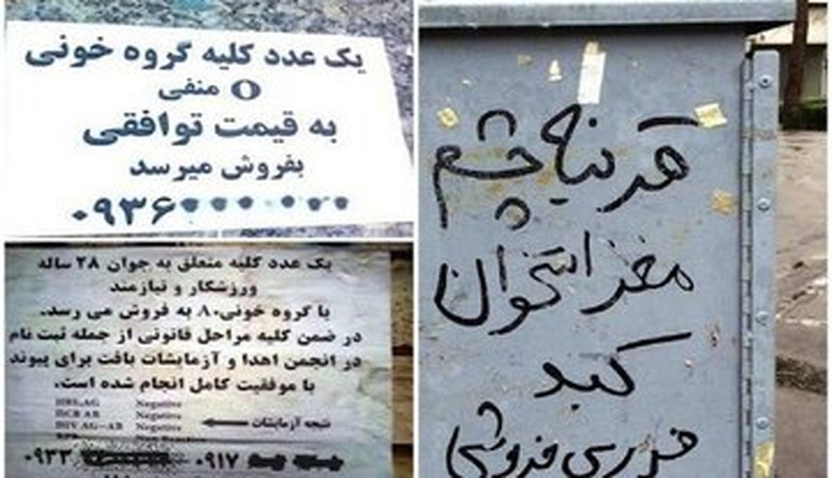 عراقی ها خریدار «کلیه» ایرانیان به قیمت دلار!