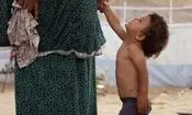 شیوع بی‌سابقه بیماری‌های پوستی در نوار غزه
